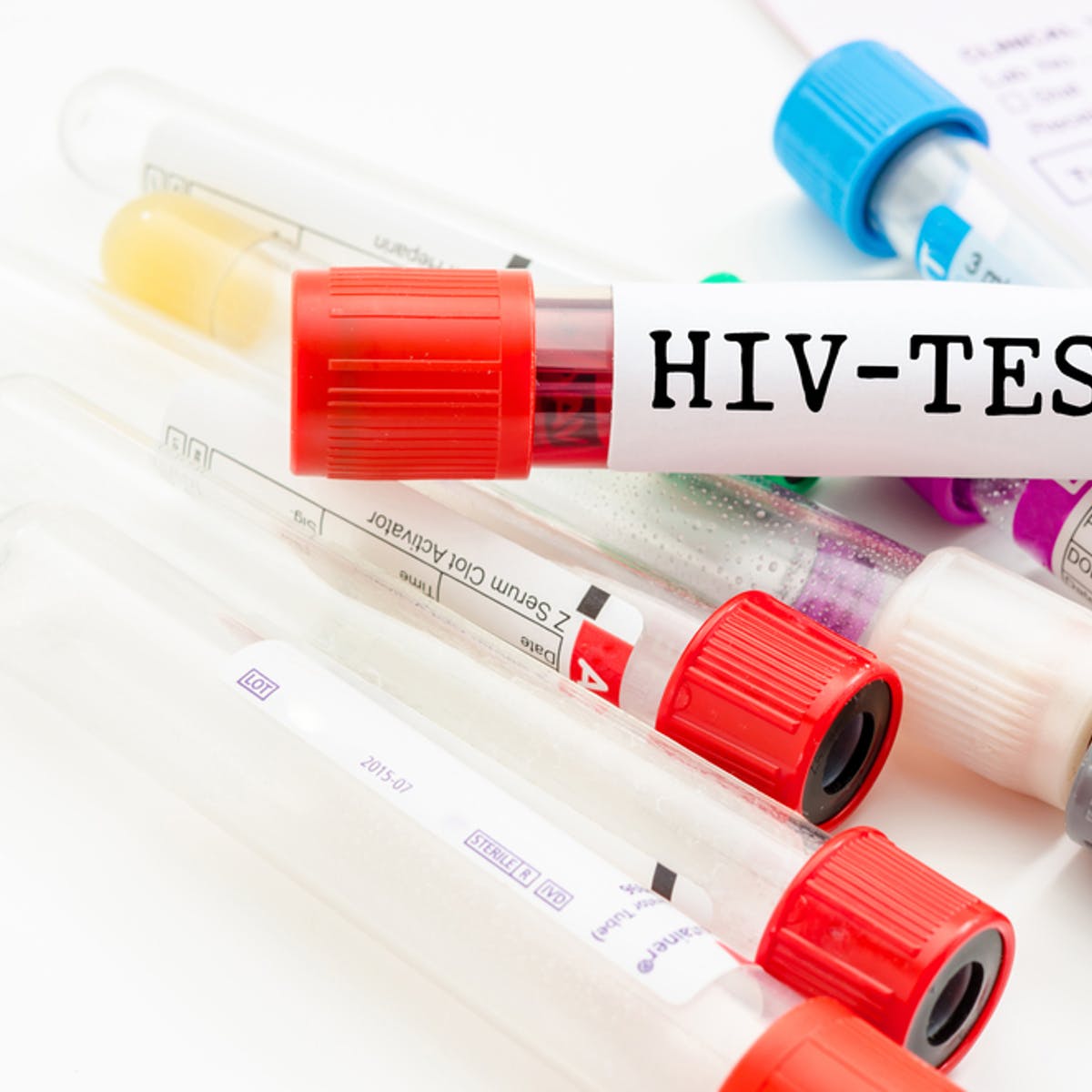 Sjutra anonimno noćno testiranje na HIV-AIDS u Domu zdravlja Podgorica