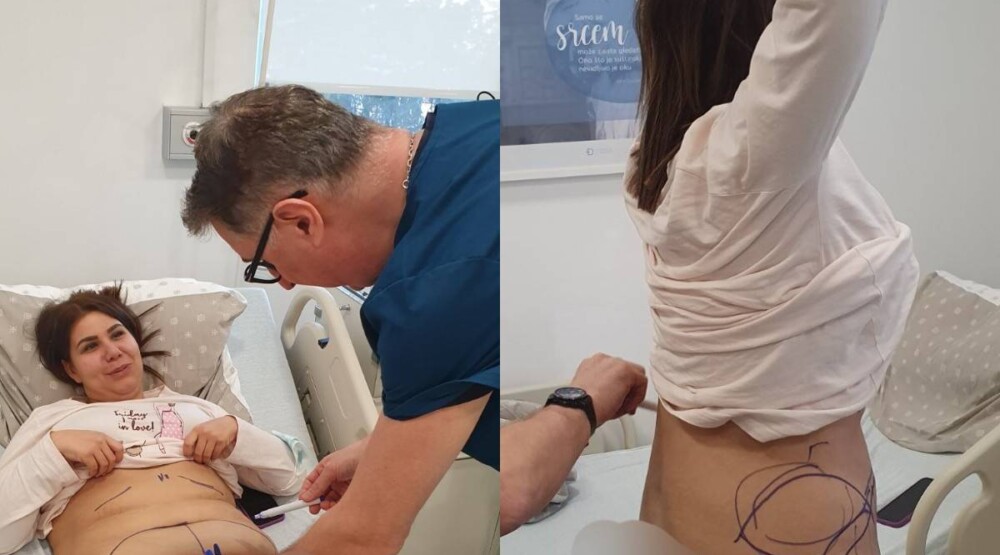 Saša Popović ispunio obećanje: Krstinja na operaciji odstranjivanja kože