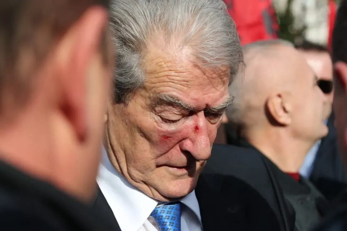 Beriša: Pustite jadnika, pravi izvođač ovog napada je Edi Rama