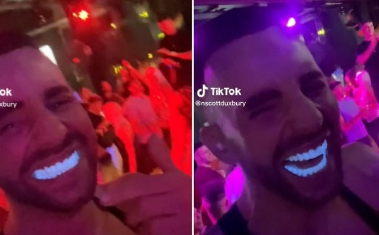 Uradio zube u Turskoj pa izašao u klub i postao hit