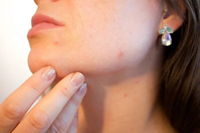 Kako tijelo pokazuje da nešto nije u redu sa našim hormonima?