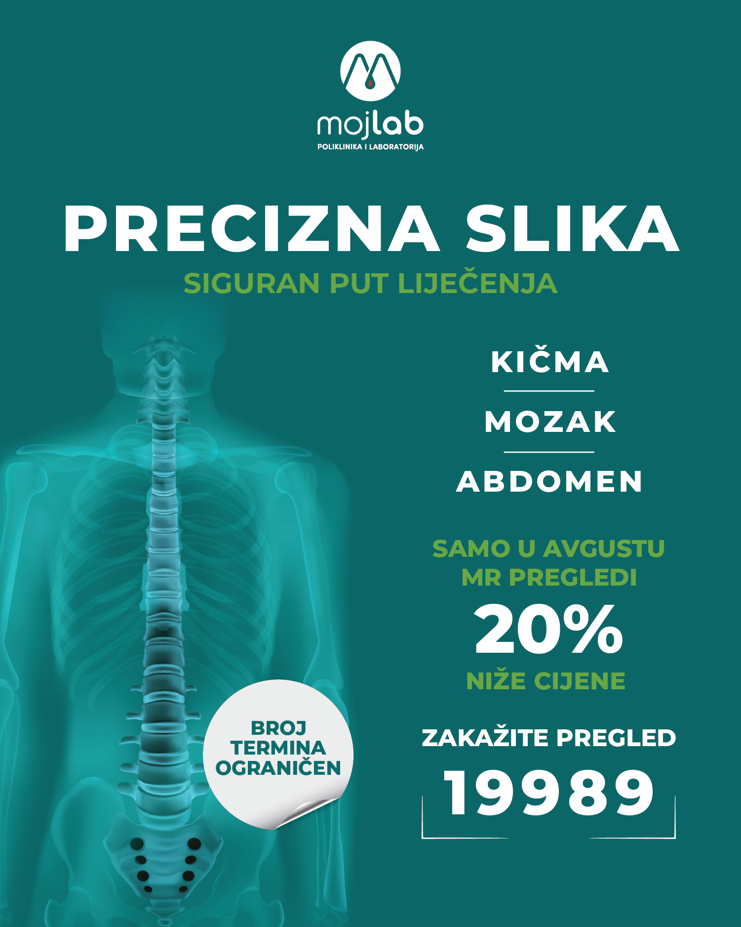 Poliklinika MOJ LAB: Promotivne cijene u avgustu za MR preglede