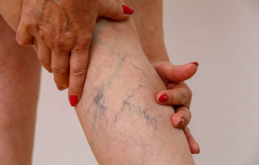Ilustracija, Foto: Shutterstock