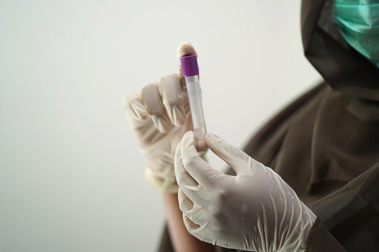 Evropska nedjelja testiranja na HIV i virusne hepatitise: Besplatno testiranje širom Crne Gore