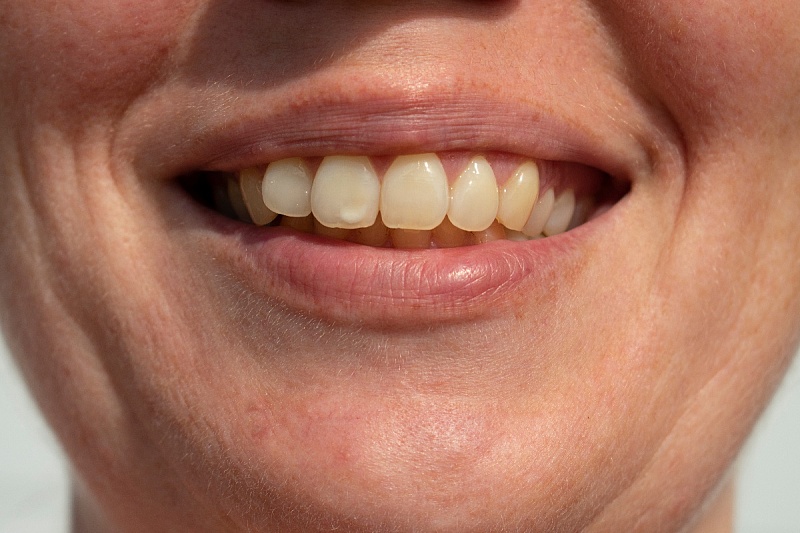 Foto: Shutterstock